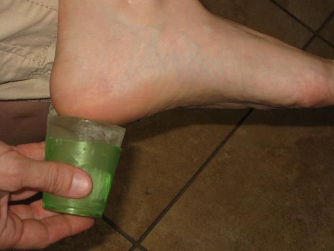 A person holding a small green glass of ice against their heel for therapy.